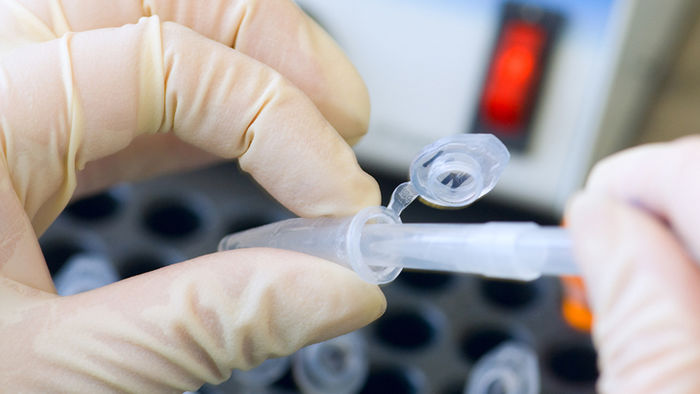 sirtex asx srx medical shares hot stock