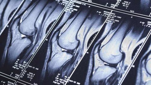 mri idx Integral Diagnostics