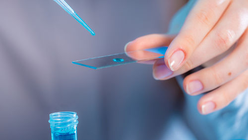 sonic healthcare shares
