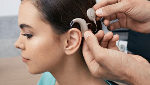 cochlear limited shares