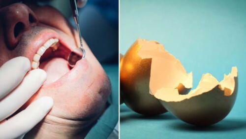 ATO warns Australians about predatory dental super schemes